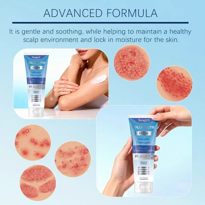 Folliculitis Soothing Cream for Folliculitis Scalp Face and Body