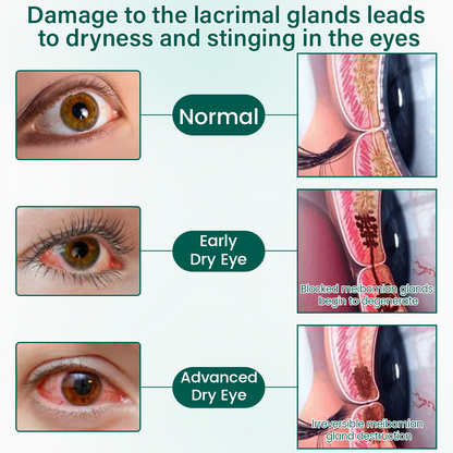 Tiworld® OptiClear Nano Eye Roller Serum