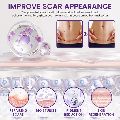 🌿 Seagril® ReGenScar Stem Cell Scar Gel-1 | Advanced Scar Repair & Skin Renewal