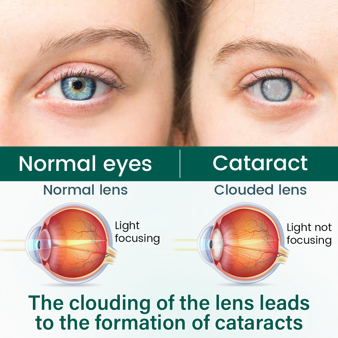 Tiworld® OptiClear Nano Eye Roller Serum