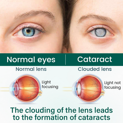 Tiworld® OptiClear Nano Eye Roller Serum