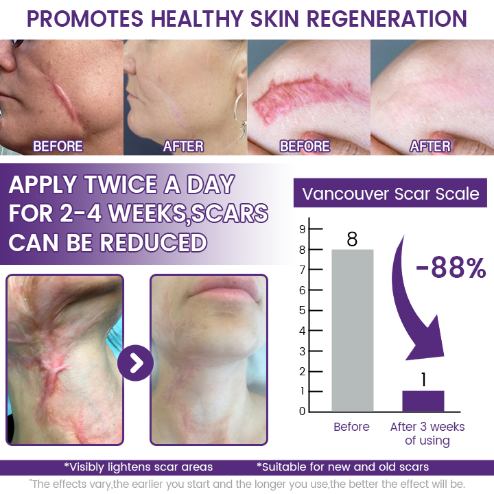 🌿 Seagril® ReGenScar Stem Cell Scar Gel-1 | Advanced Scar Repair & Skin Renewal