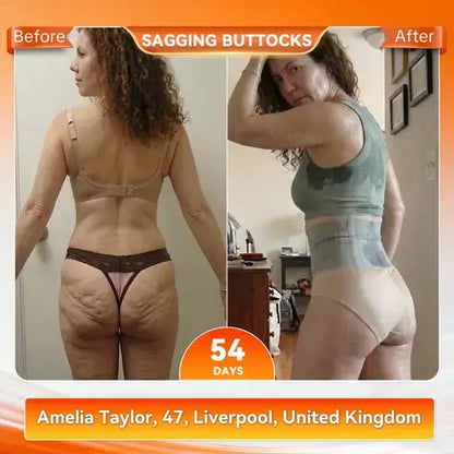 SEAGRIL® 𝐌𝐨𝐫𝐢𝐧𝐠𝐚 & 𝐁𝐞𝐫𝐛𝐞𝐫𝐢𝐧𝐞 4‑In‑1 Micro‑Particle Sculpting & Fat‑Burn Shorts