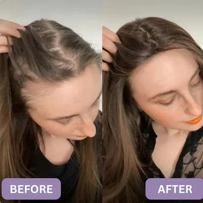 Rosemary Anti-Hair Fall Shampoo