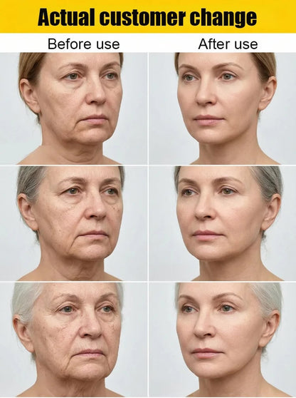 [10-Year Rejuvenation] 🔥SEAGRIL® Collagen Fullerene Cell Regeneration Cream🔥