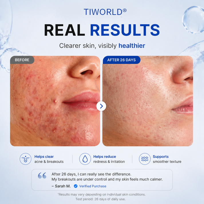 Tiworld® 4-in-1 Bio-Active Protocol: Anti-Acne, Calming, Mark-Fading & Oil-Control