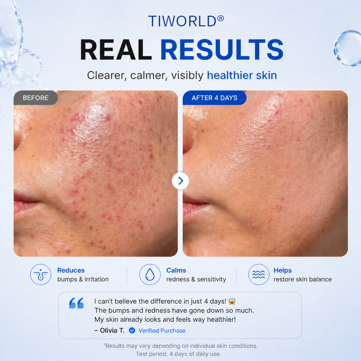 Tiworld® 4-in-1 Bio-Active Protocol: Anti-Acne, Calming, Mark-Fading & Oil-Control
