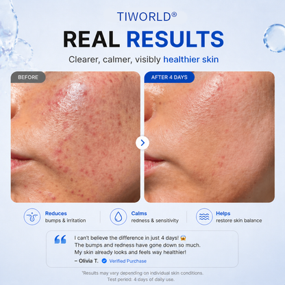 Tiworld® 4-in-1 Bio-Active Protocol: Anti-Acne, Calming, Mark-Fading & Oil-Control