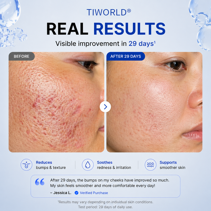 Tiworld® 4-in-1 Bio-Active Protocol: Anti-Acne, Calming, Mark-Fading & Oil-Control