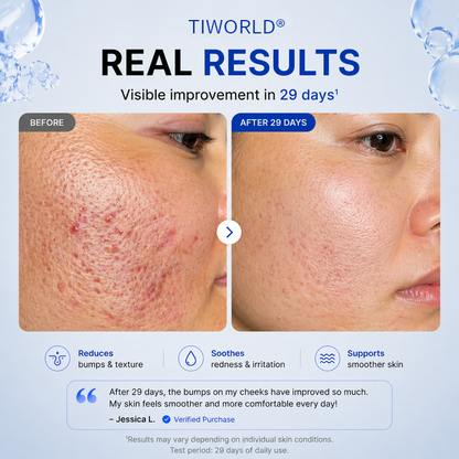 Tiworld® 4-in-1 Bio-Active Protocol: Anti-Acne, Calming, Mark-Fading & Oil-Control