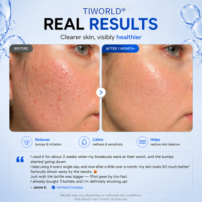 Tiworld® 4-in-1 Bio-Active Protocol: Anti-Acne, Calming, Mark-Fading & Oil-Control
