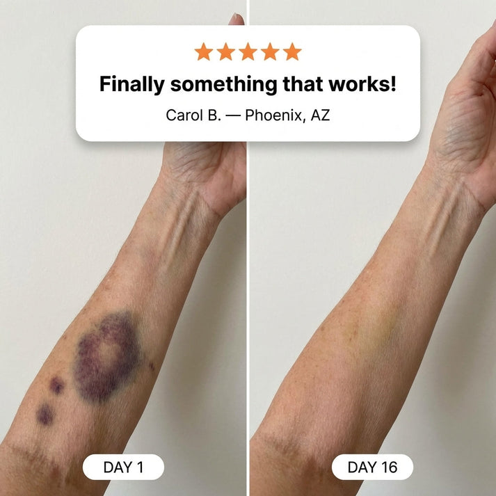 💥100K+ SOLD💕SEAGRIL® Bruise Repair & Skin-Strengthening Cream