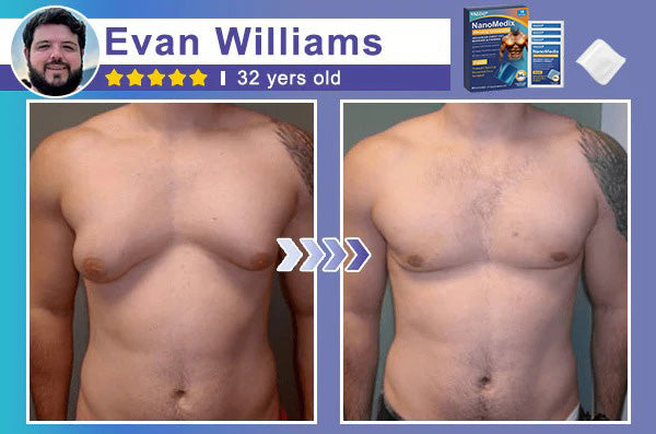 🔥Limited-time 50% sale🔥Yagoo® Chest Fatburn & Firm Patch-Transdermal Lipolysis: Engineered for the Male Physique.