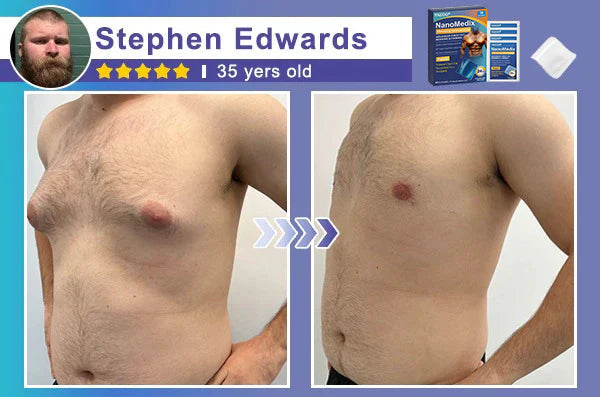 🔥Limited-time 50% sale🔥Yagoo® Chest Fatburn & Firm Patch-Transdermal Lipolysis: Engineered for the Male Physique.