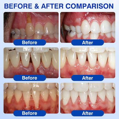 🏆🦷🛡️Tiworld® Periodontal Repair Gel