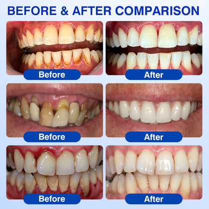 🏆🦷🛡️Tiworld® Periodontal Repair Gel