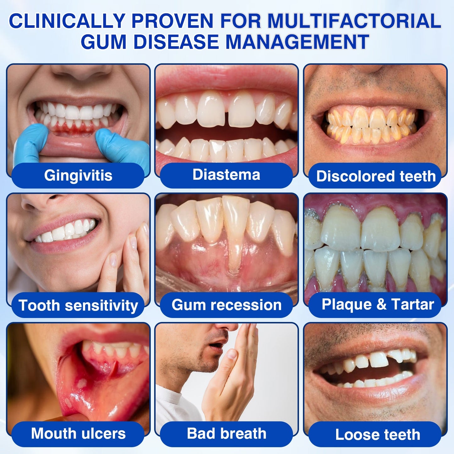 🏆🦷🛡️Tiworld® Periodontal Repair Gel