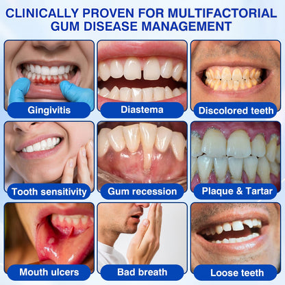 🏆🦷🛡️Tiworld® Periodontal Repair Gel
