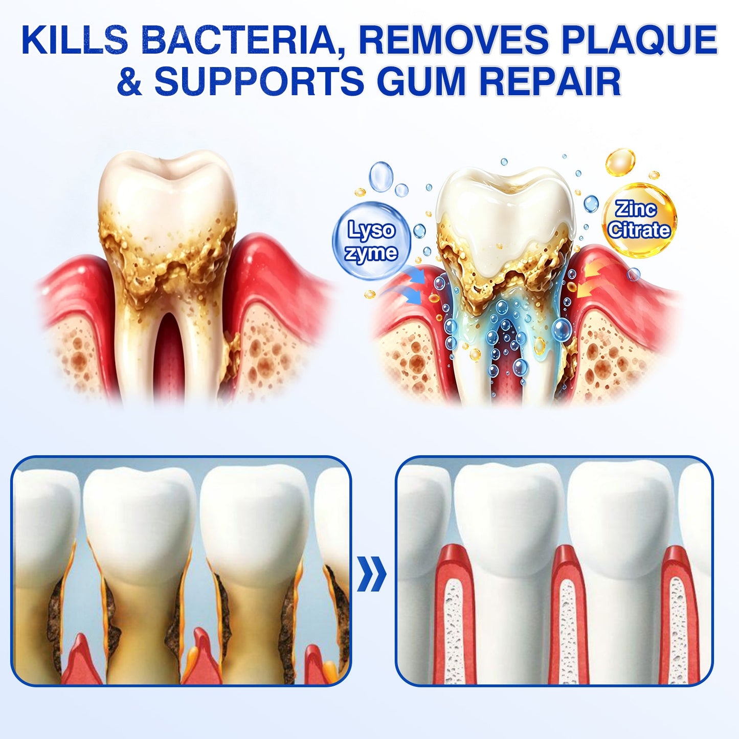 🏆🦷🛡️Tiworld® Periodontal Repair Gel