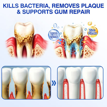 🏆🦷🛡️Tiworld® Periodontal Repair Gel