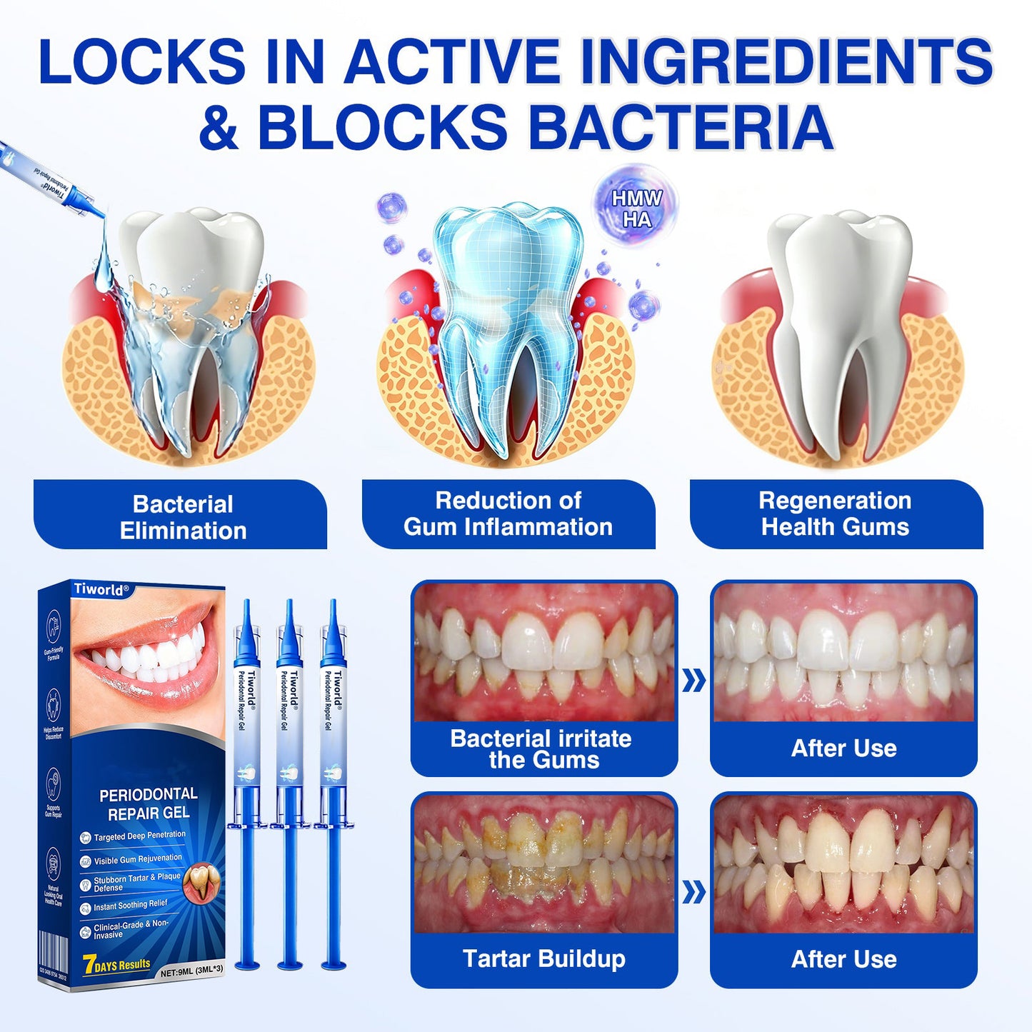 🏆🦷🛡️Tiworld® Periodontal Repair Gel