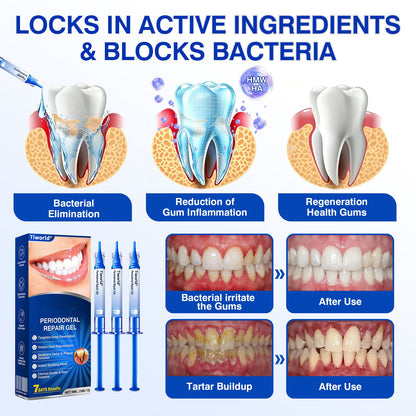 🏆🦷🛡️Tiworld® Periodontal Repair Gel