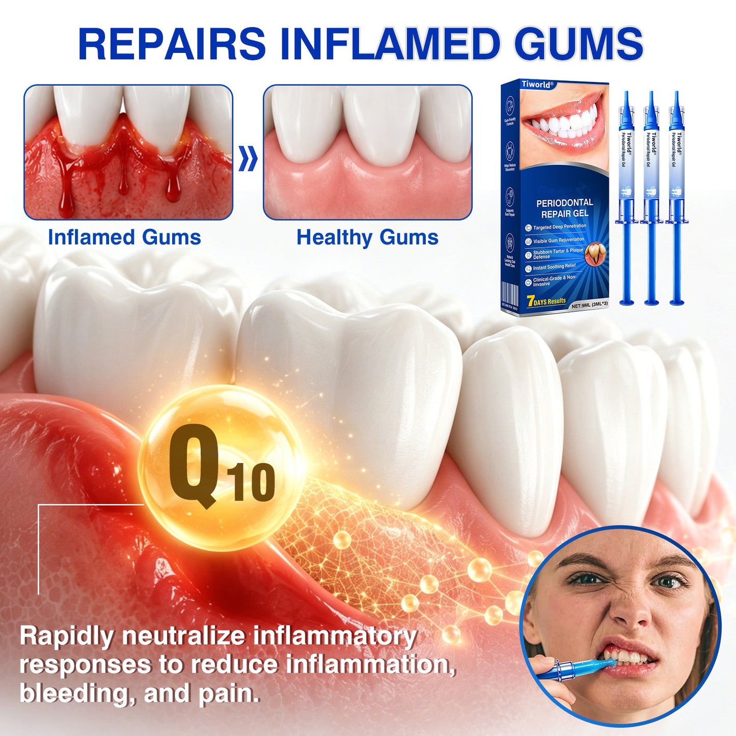 🏆🦷🛡️Tiworld® Periodontal Repair Gel